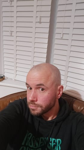 Customer photo review of Seb Natural Soothing Balm