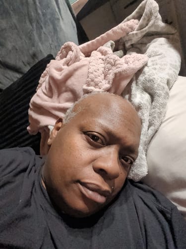 Close-up of a reviewer showing new, fuzzy hair growth at their hairline after using Rennora Hair Growth Serum.