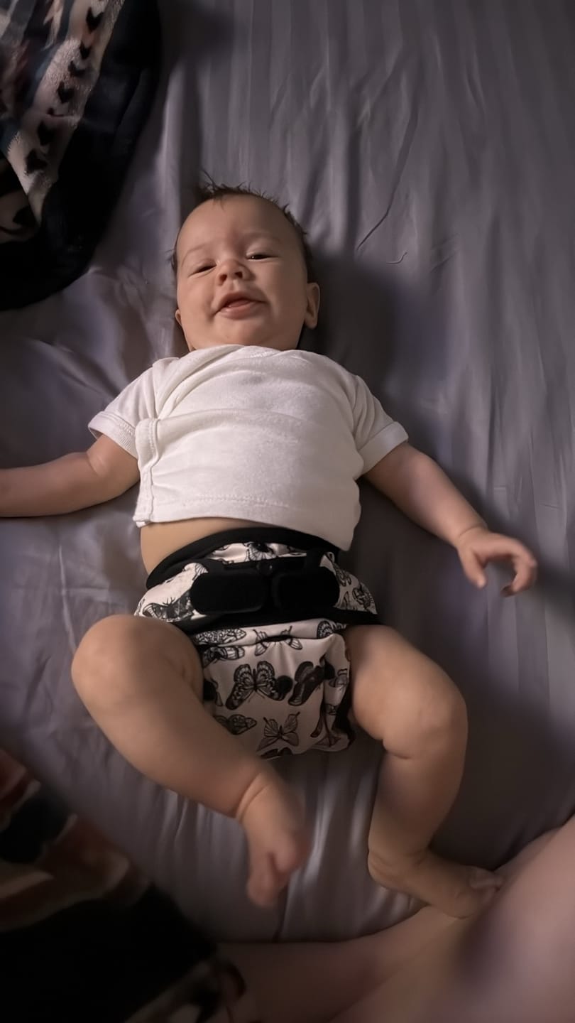 Customer photo review of Tiny Tushies Newborn Hook & Loop Covers