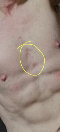 Customer photo review of Seb Natural Calming Serum