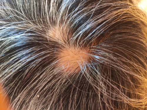 Customer photo review of Set Shampoo + Acondicionador + Mascarara Reparación Aloe & Argan