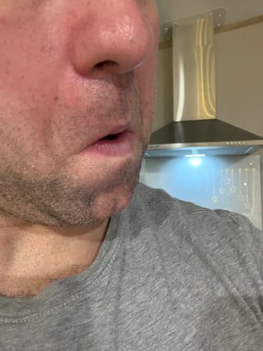 Customer photo review of Seb Natural Calming Serum