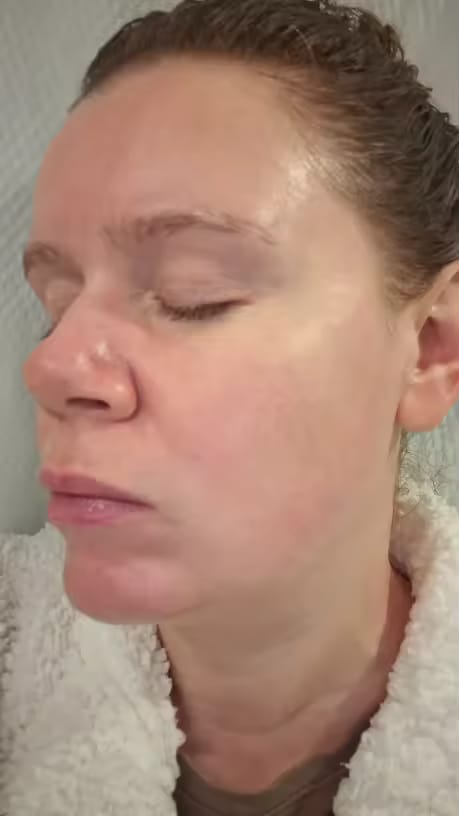 Customer photo review of CollaGlow - 30 Tage Kollagen-Kur