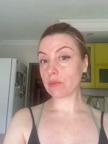 Customer photo review of CollaGlow - 30 Tage Kollagen-Kur