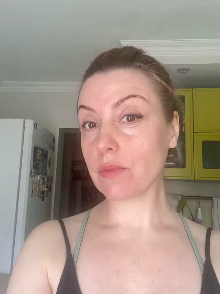 Customer photo review of CollaGlow - 30 Tage Kollagen-Kur
