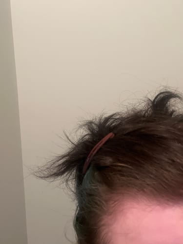 Close-up of a reviewer's hair and scalp after using the Shampoo.