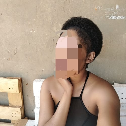 Customer photo review of Minoxidil High Strength (5%) SOLUTION, 3x60ml pack