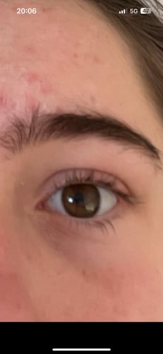 Customer photo review of iGlow Lash Maximizer - Lash Serum, 3 ml