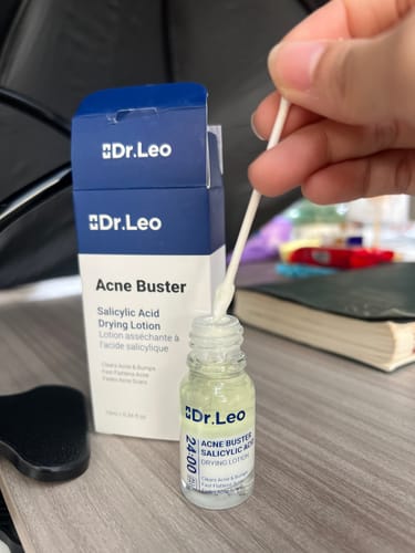 Customer photo review of Salicylic Acid Acne Treatment Drying Lotion