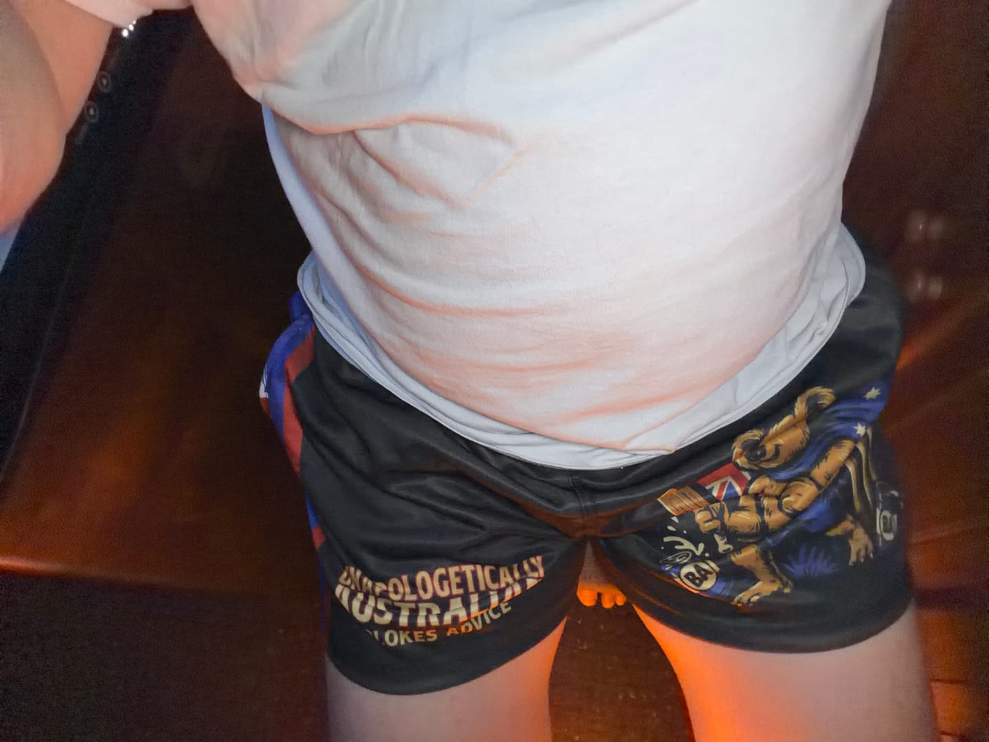 Customer photo review of Aussie As Footy Shorts