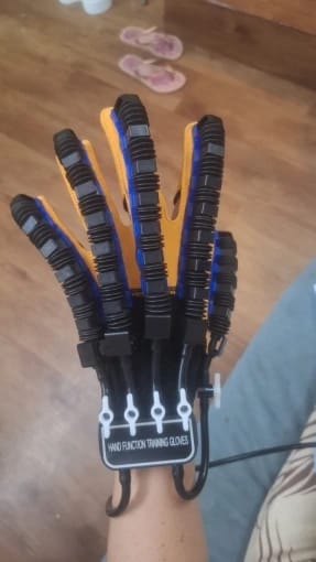 Customer photo review of ReGrip™ | Rehabilitation Glove