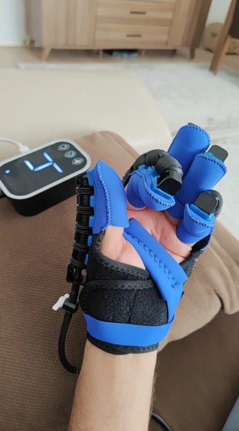 Customer photo review of ReGrip™ | Rehabilitation Glove