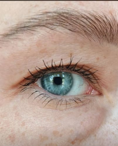 Customer photo review of Toplash eyelash and eyebrow growth serum — 3ml