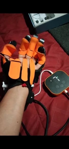 Customer photo review of ReGrip™ | Rehabilitation Glove
