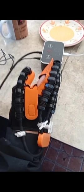 Customer photo review of ReGrip™ | Rehabilitation Glove