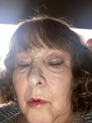 Customer photo review of FYNE SHYNE CREAM HIGHLIGHTER