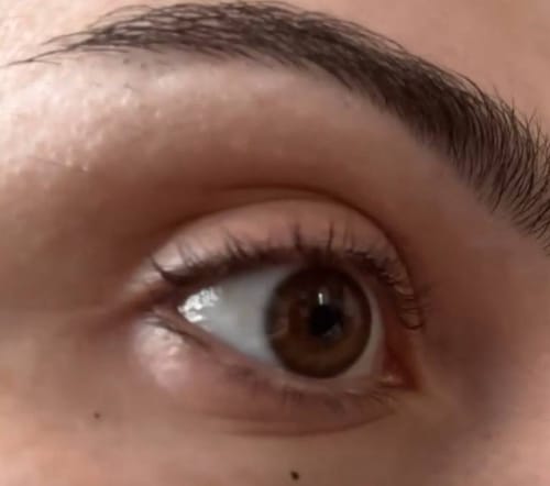Customer photo review of Toplash eyelash and eyebrow growth serum — 3ml