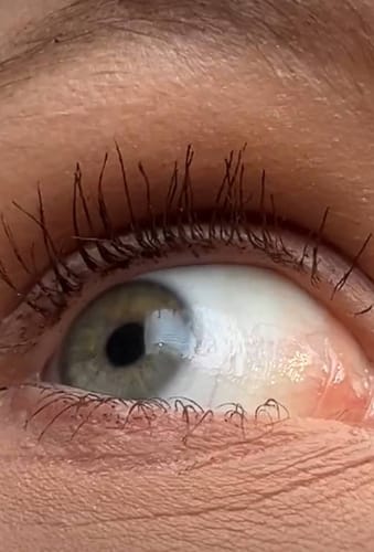Customer photo review of Toplash eyelash and eyebrow growth serum — 3ml
