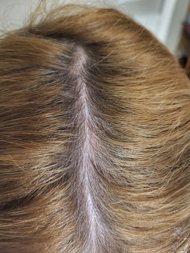 Customer photo review of Ultimate Hair Strength PRO Supplements- 90 Days