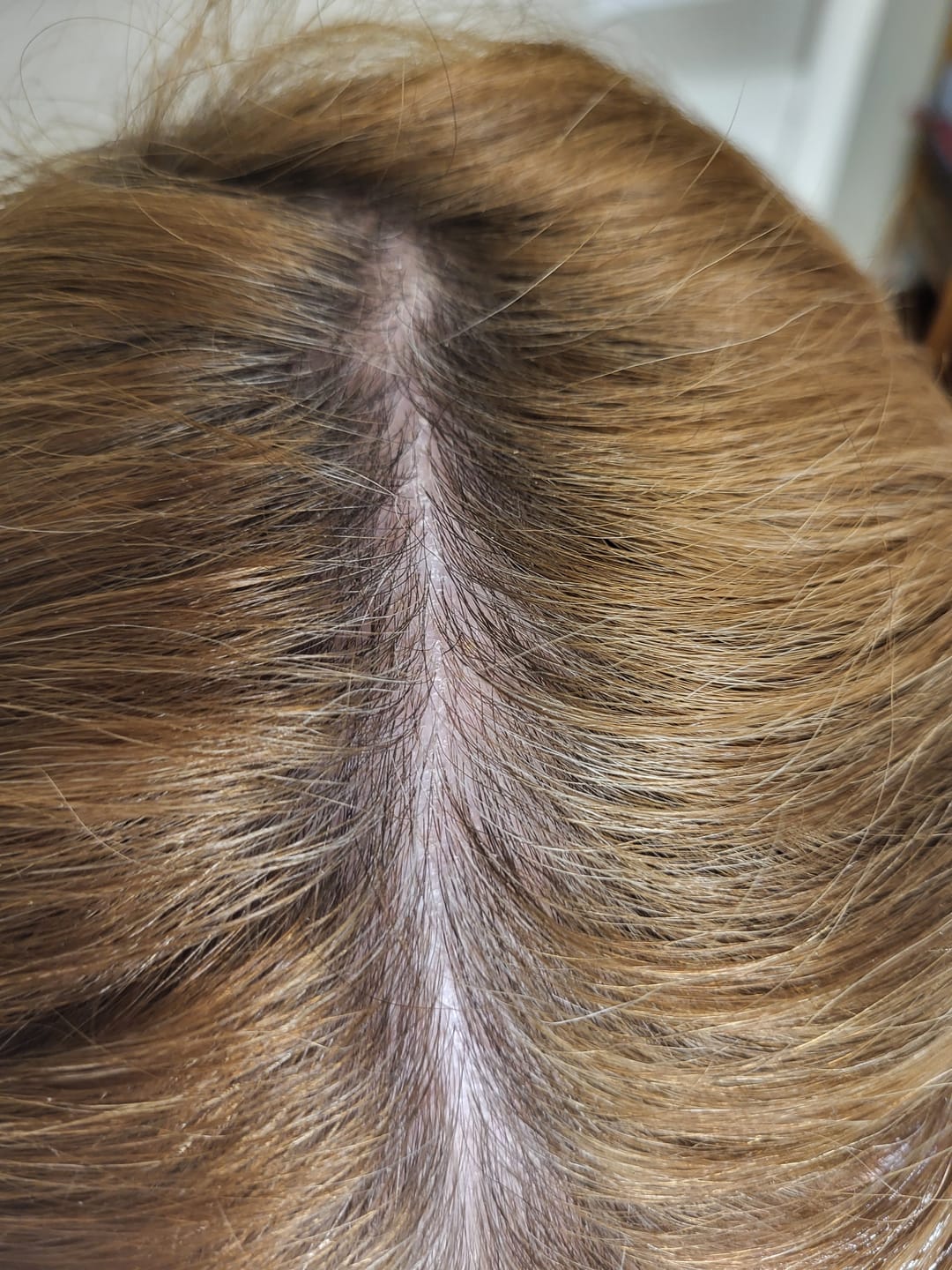 Customer photo review of Ultimate Hair Strength PRO Supplements- 90 Days