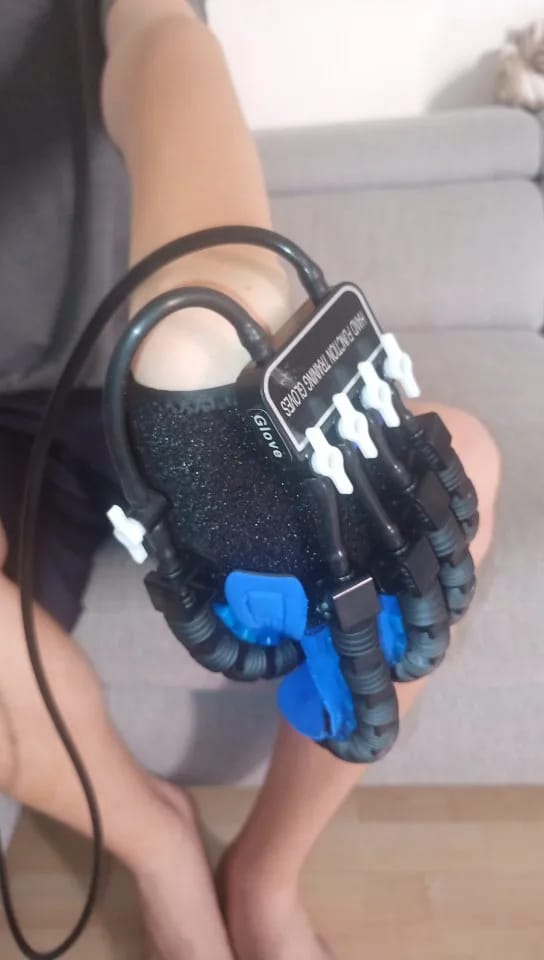 Customer photo review of ReGrip™ | Rehabilitation Glove