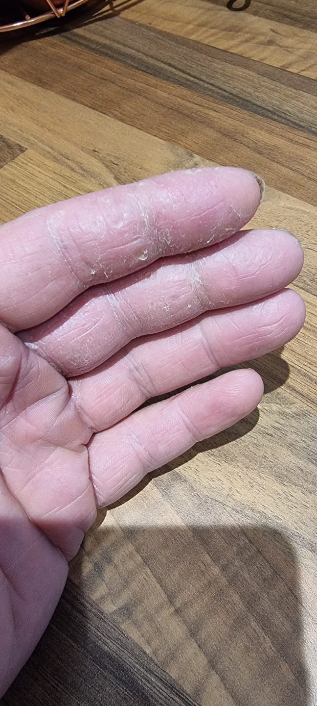 Customer photo review of Bioskin Duo Pack
