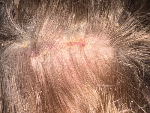 Customer photo review of Seb Natural Calming Serum