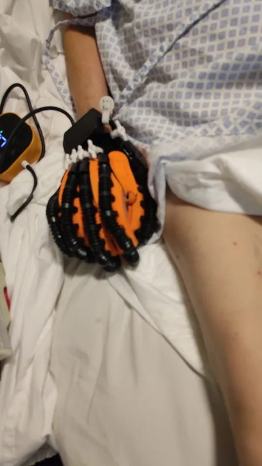 Customer photo review of ReGrip™ | Rehabilitation Glove