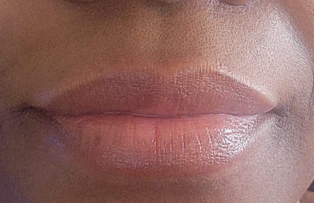 Customer photo review of Lips Lightening Cream For Men and Women (Results in 5 Days or Less)
