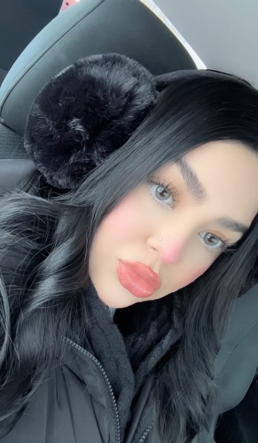 Customer photo review of Hinata Fresh Hazel Brown Prescription Colored Contact Lenses