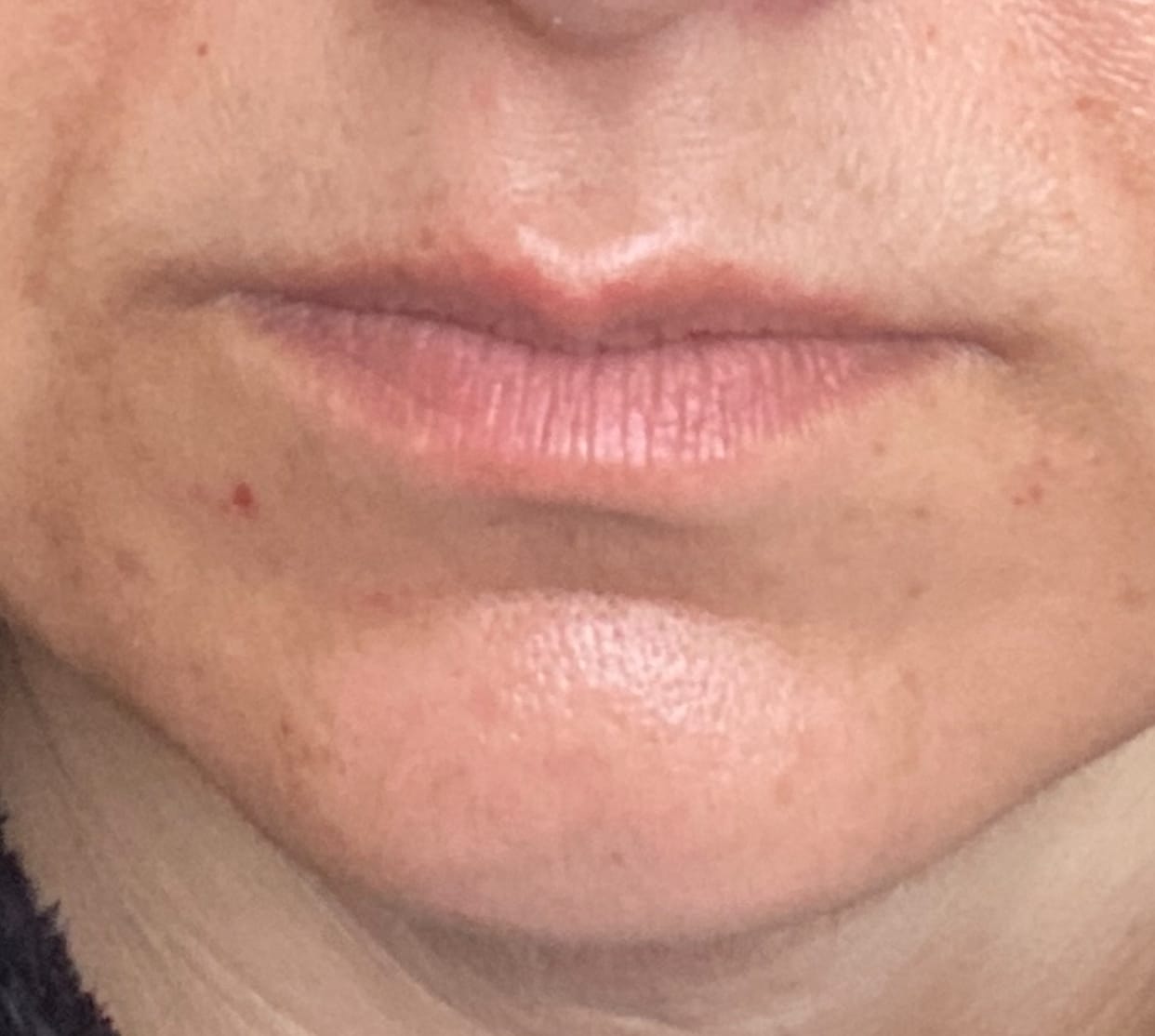 Customer photo review of PDRN collagen lip mask Glazed jelly