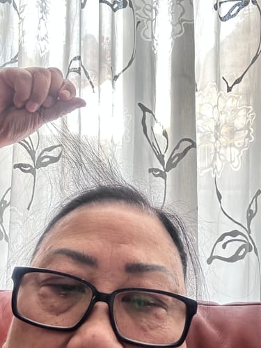 Customer photo review of Scalp Activating Serum