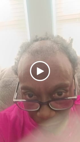 Customer video review of 1 Bottle of Rennora Hair Growth Serum (CYBER MONDAY SPECIAL)