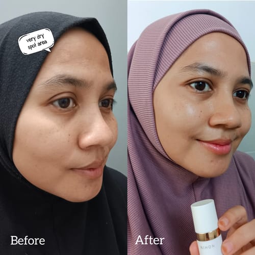 Customer's before-and-after photo. Skin appears more radiant and hydrated after using the Gold Radiance Serum.