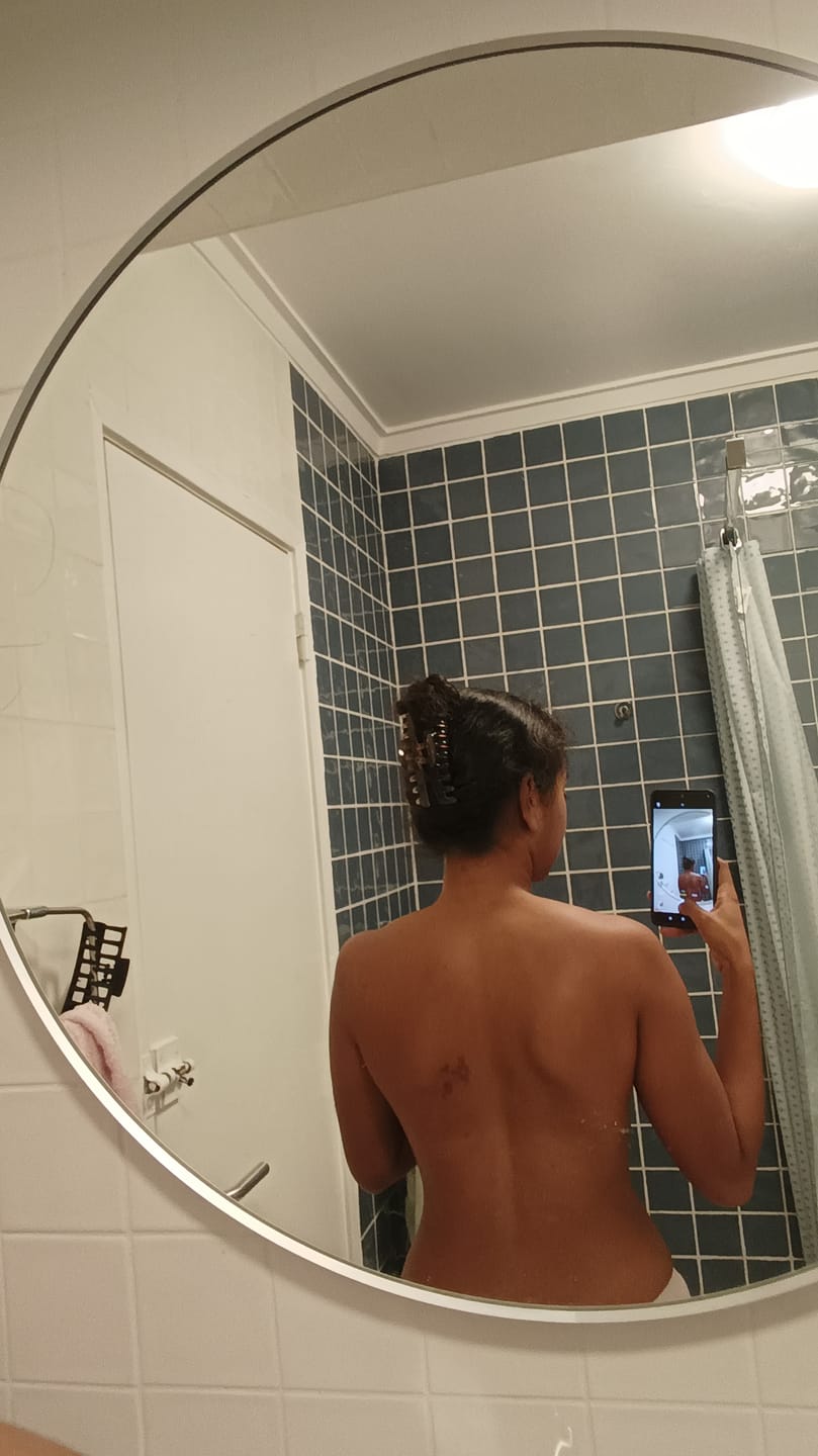 Customer photo review of Exfoliating Body & Face Bar – 3% Salicylic Acid + 10% Sulphur Soap