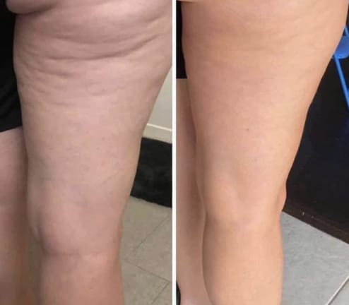 Customer photo review of Huile Liftante Anti-Rides Corps