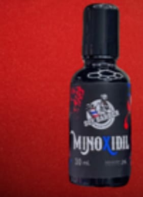 Customer photo review of Soy Barber - Minoxidil 30ml