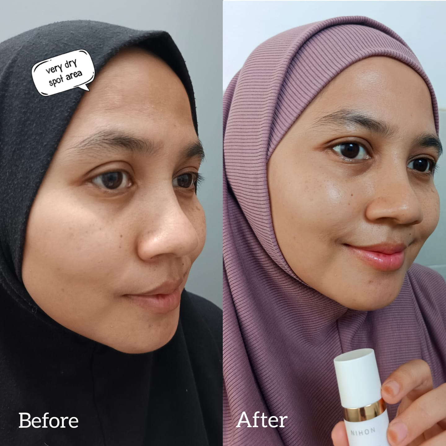 Customer photo review of Gold Radiance Serum Travel