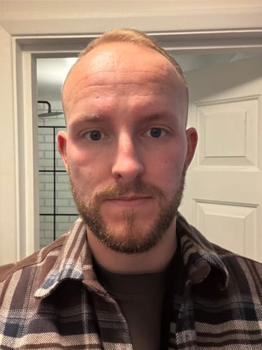 Customer photo review of Seb Natural Calming Serum