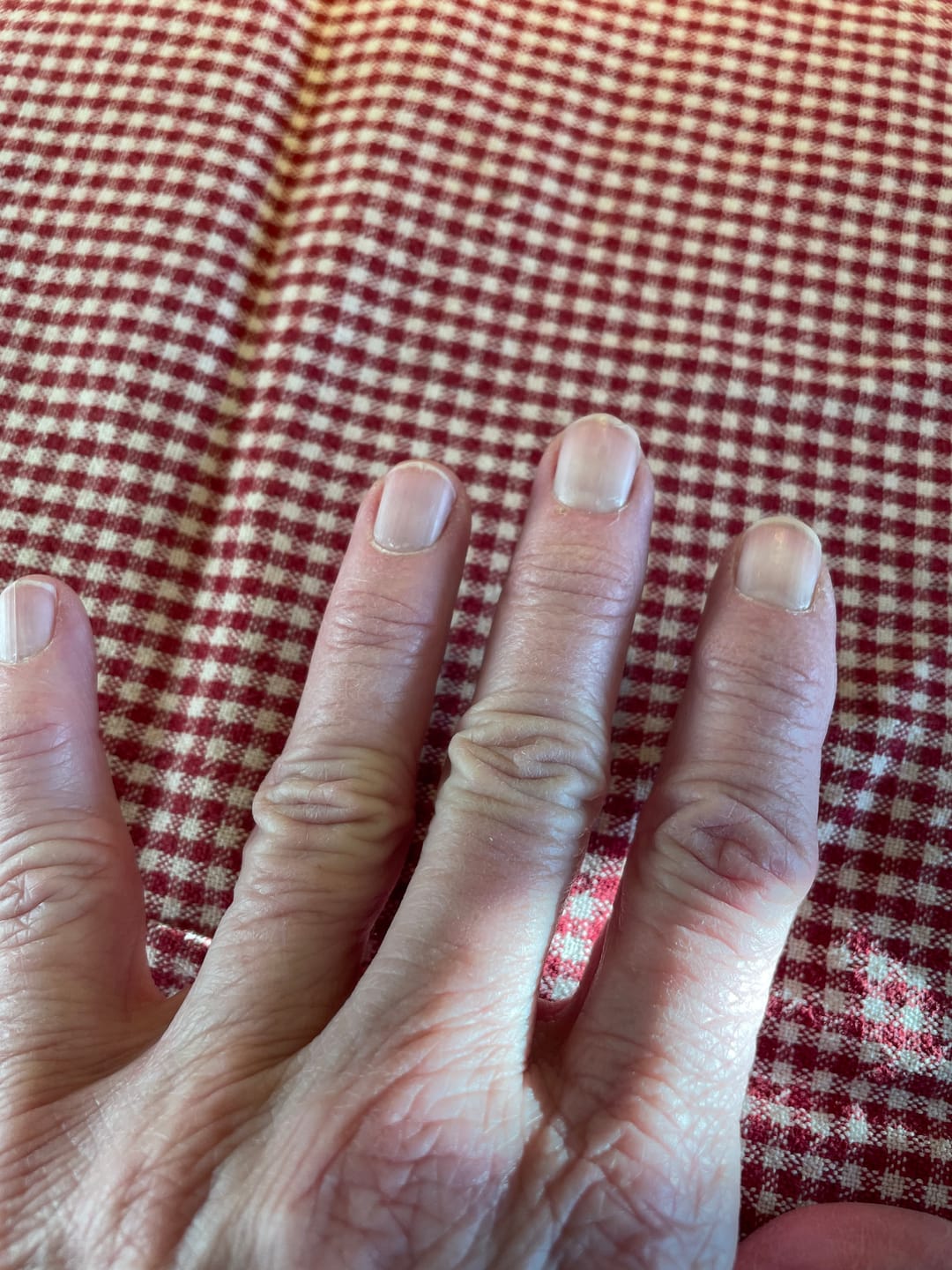 Reseña fotográfica de un cliente sobre Manos suaves - con rosa y raíz de rosa