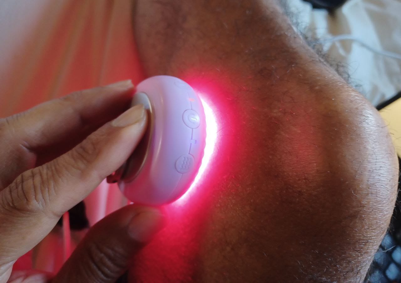 Customer photo review of Koanna® Deepr™ ØØ5 – Red Light Face Contouring Device