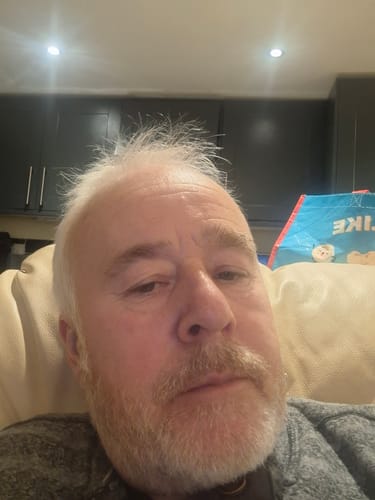 Customer photo review of Seb Natural Calming Serum