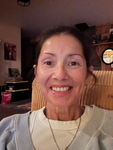 Customer smiling, showing improved skin texture and reduced fine lines after using the Seranova Micro Infusion System.