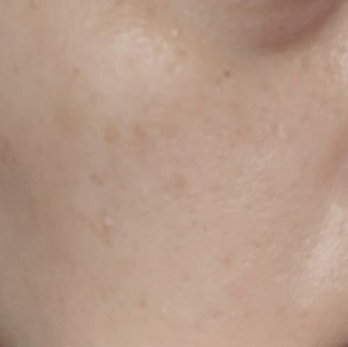 Close-up: Reviewer's hydrated skin after using the Tripeptide Barrier Recovery Essence.