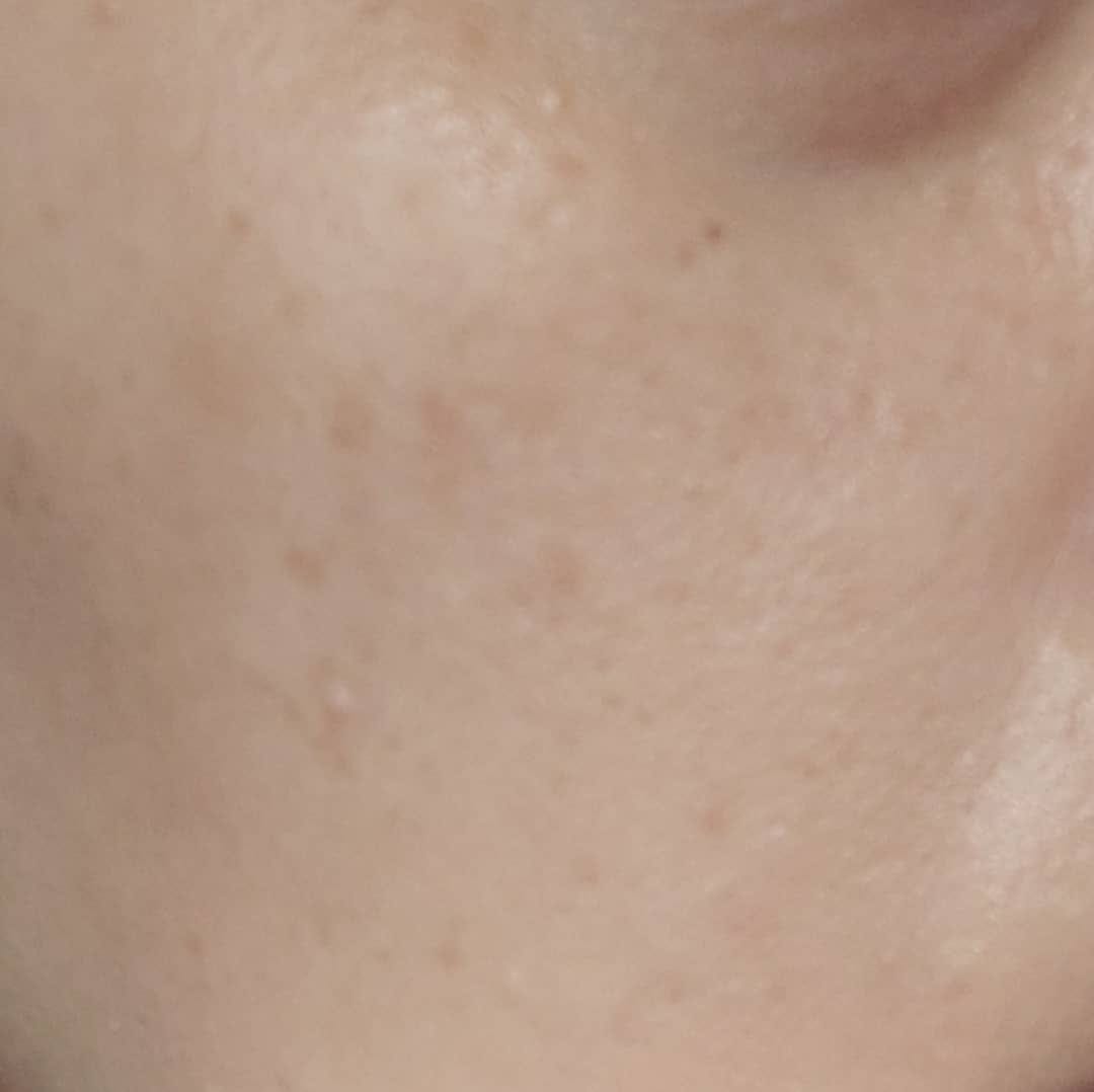 Customer photo review of Tripeptide Barrier Recovery Essence