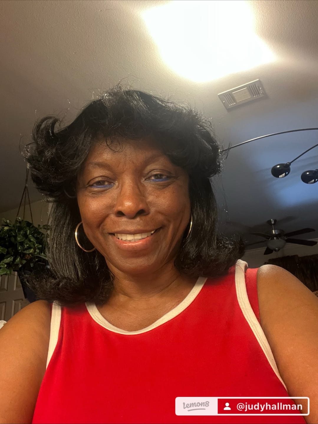 Customer photo review of Lemonvate Brightening Cream 50g