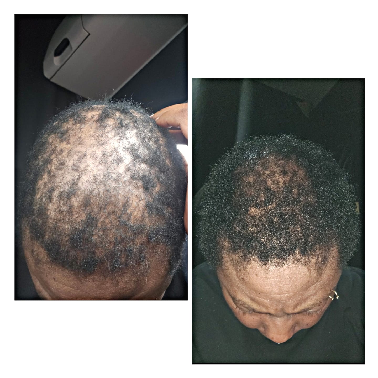 Customer photo review of HairStem Spray