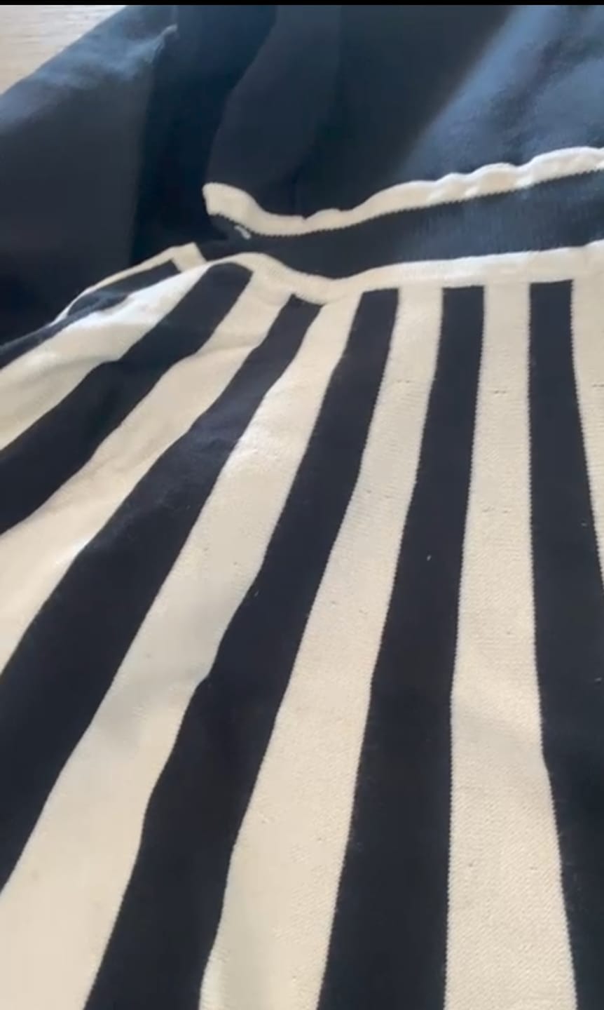 Customer photo review of Vestido corto stripes