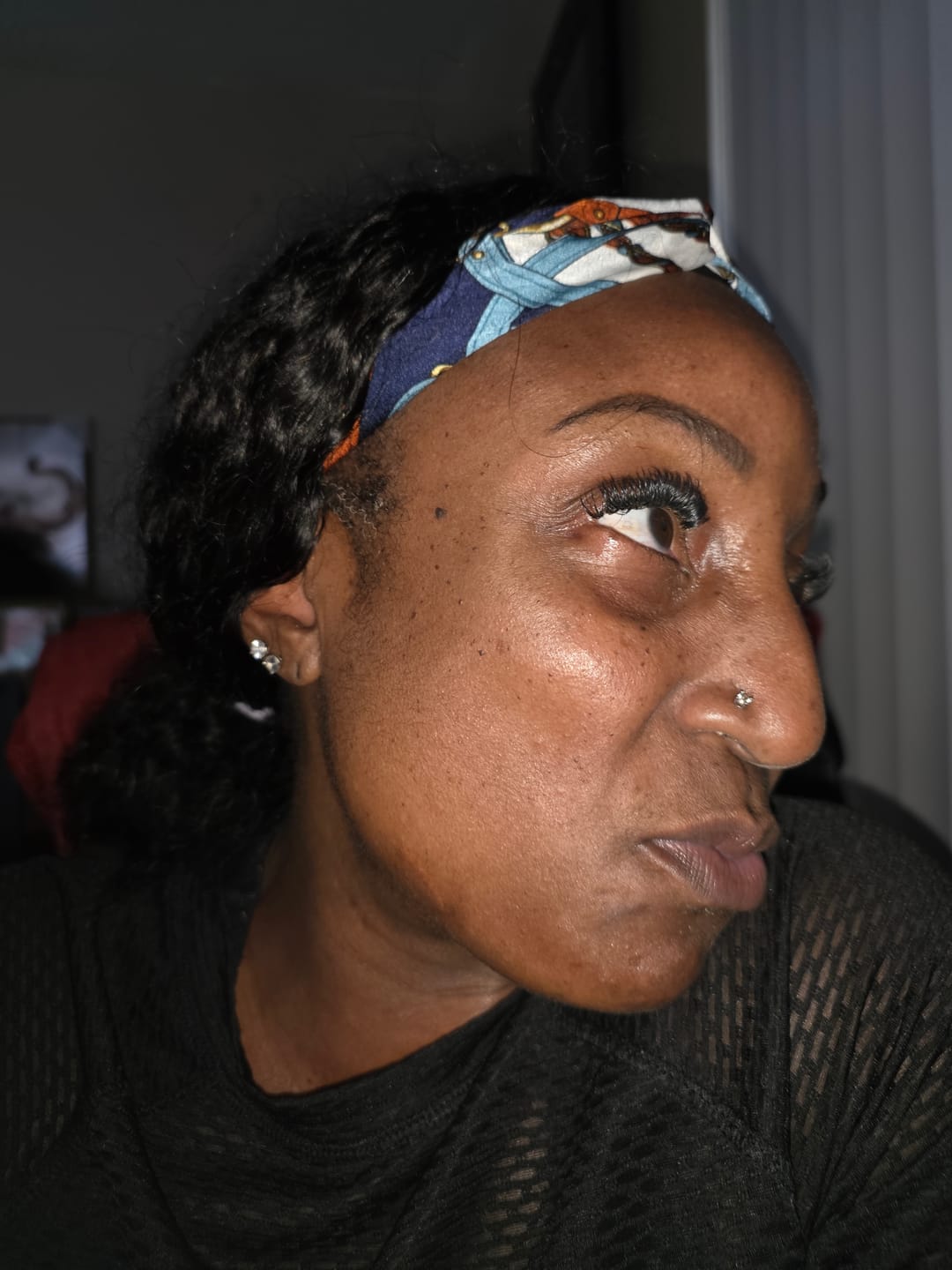 Customer photo review of Dark Spot Roller 50 ml (inner thighs and underarms)