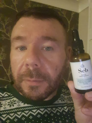 Customer photo review of Seb Natural Calming Serum